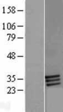 Novus Biologicals&trade;&nbsp;FOLR2 Overexpression Lysate