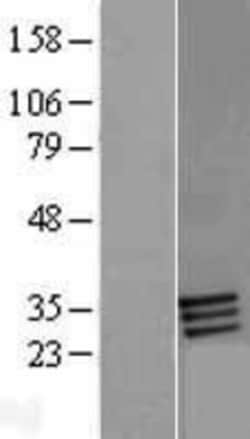 Novus Biologicals FOLR2 Overexpression Lysate 0.1mg | Buy Online | Novus Biologicals&trade; | Fisher Scientific