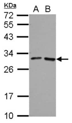 FOLR4 Antibody, Novus Biologicals 0.1mL; Unlabeled:Antibodies, Polyclonal
