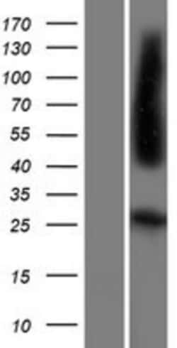 Novus Biologicals&trade;&nbsp;FOLR4 Overexpression Lysate