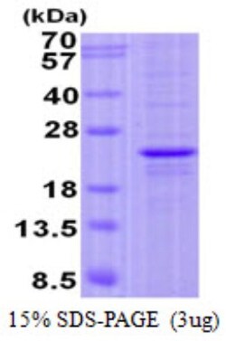 Novus Biologicals&trade;&nbsp;Recombinant Human FOPNL His Protein