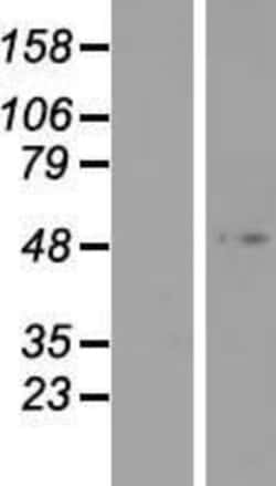 Novus Biologicals&trade;&nbsp;Forkhead box D4-like 3 Overexpression Lysate