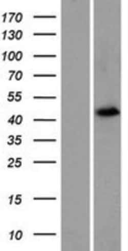 Novus Biologicals™ Forkhead box D4-like 4 Overexpression Lysate