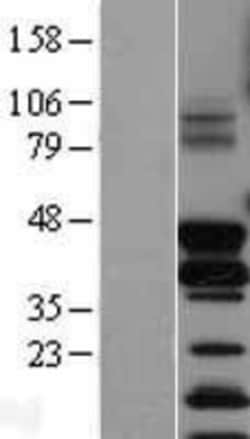 Novus Biologicals&trade;&nbsp;FosB/G0S3 Overexpression Lysate