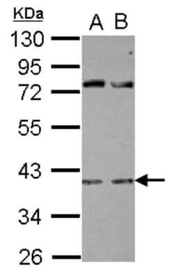FOX2 Antibody, Novus Biologicals 0.1mL; Unlabeled:Antibodies, Polyclonal