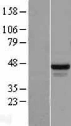 Novus Biologicals™ FOX2 Overexpression Lysate