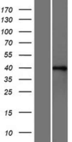 Novus Biologicals™ FOX2 Overexpression Lysate