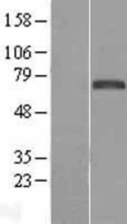 Novus Biologicals™ FoxC1 Overexpression Lysate