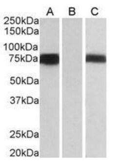 FoxC1 Antibody, Novus Biologicals 0.1 mg | Buy Online | Novus Biologicals | Fisher Scientific