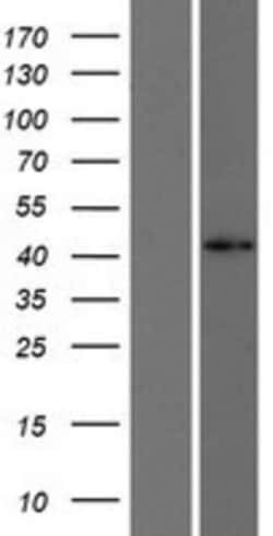 Novus Biologicals&trade;&nbsp;FOXD4L1 Overexpression Lysate