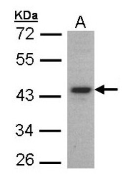 FOXE1 Antibody, Novus Biologicals 100 &mu;L | Buy Online | Novus Biologicals | Fisher Scientific