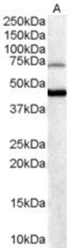 FOXG1 Antibody, Novus Biologicals 0.1mg; Unlabeled:Antibodies, Polyclonal