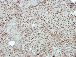 FOXI1 Antibody, Novus Biologicals 0.1mL; Unlabeled:Antibodies, Polyclonal