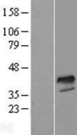 Novus Biologicals&trade;&nbsp;FOXI1 Overexpression Lysate