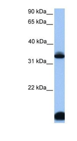 FOXI3 Antibody, Novus Biologicals 100 &mu;L | Buy Online | Novus Biologicals | Fisher Scientific