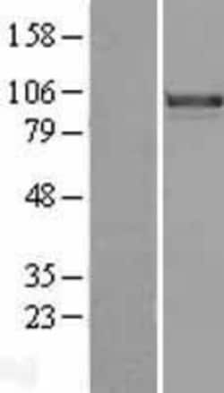 Novus Biologicals&trade;&nbsp;FoxM1 Overexpression Lysate