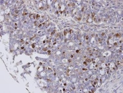 FoxM1 Antibody, Novus Biologicals 0.1mg; Unlabeled:Antibodies, Polyclonal