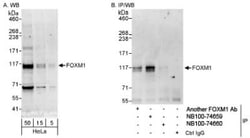 FoxM1 Antibody, Novus Biologicals 0.1mg; Unlabeled:Antibodies, Polyclonal