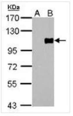 FoxM1 Antibody, Novus Biologicals 0.1mg; Unlabeled:Antibodies, Polyclonal