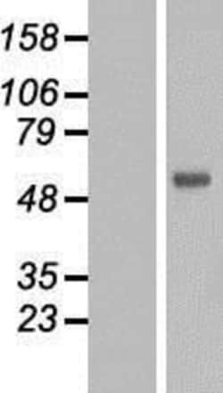 Novus Biologicals&trade;&nbsp;FOXN2 Overexpression Lysate