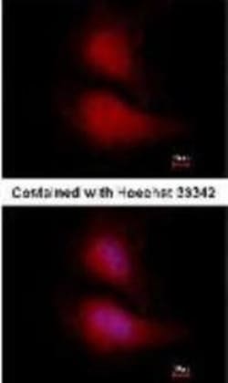 FOXO1A/3/4 Antibody (14E4), Novus Biologicals 0.1mg; Unlabeled:Antibodies,