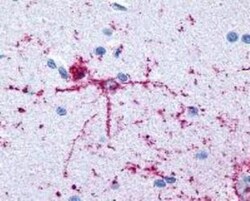 FOXO1A/3/4 Antibody (4E7), Novus Biologicals 0.1mg; Unlabeled:Antibodies,