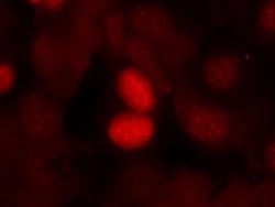 FoxO1/FKHR, p Ser256 Antibody, Novus Biologicals:Antibodies:Primary Antibodies