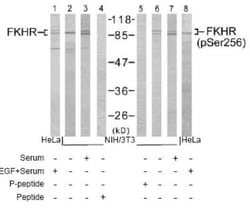FoxO1/FKHR, p Ser256 Antibody, Novus Biologicals:Antibodies:Primary Antibodies