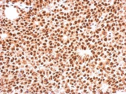 FOXO3 Antibody, Novus Biologicals 0.1 mL | Buy Online | Novus Biologicals | Fisher Scientific