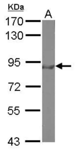 FOXO3 Antibody, Novus Biologicals 0.1 mL | Buy Online | Novus Biologicals | Fisher Scientific