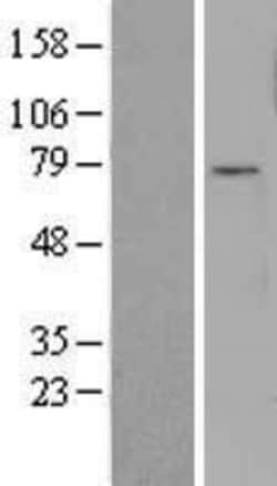 Novus Biologicals™ FOXO3 Overexpression Lysate