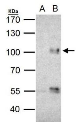 FOXO3 Antibody, Novus Biologicals 0.1 mL | Buy Online | Novus Biologicals | Fisher Scientific