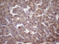 FOXO4 Antibody (OTI1A4), Novus Biologicals 0.1 mL | Buy Online | Novus Biologicals | Fisher Scientific