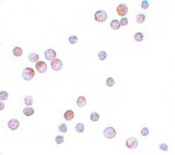 FOXO4 Antibody - BSA Free, Novus Biologicals 0.1mg; Unlabeled:Antibodies,