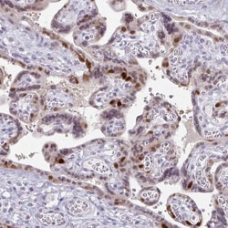 FOXO4 Antibody, Novus Biologicals:Antibodies:Primary Antibodies