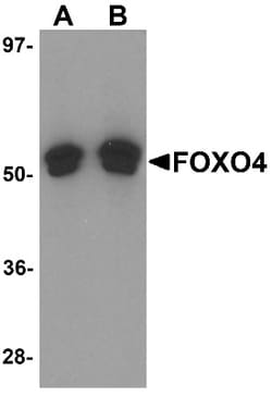 FOXO4 Antibody - BSA Free, Novus Biologicals 0.1mg; Unlabeled:Antibodies