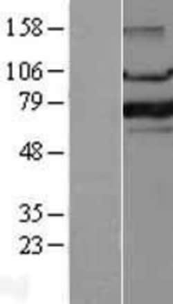 Novus Biologicals&trade;&nbsp;FoxP1 Overexpression Lysate