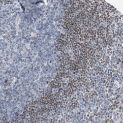FoxP1 Antibody, Novus Biologicals:Antibodies:Primary Antibodies