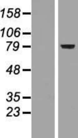 Novus Biologicals&trade;&nbsp;FoxP2 Overexpression Lysate