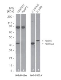 FoxP3 Antibody (16J4G6) - Delta 2 (exon 2 deleted) specific, Novus Biologicals