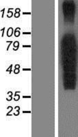 Novus Biologicals™ FoxP4 Overexpression Lysate