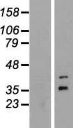 Novus Biologicals&trade;&nbsp;FOXR1 Overexpression Lysate