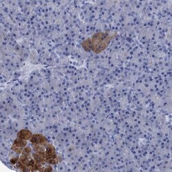 FOXR2 Antibody, Novus Biologicals:Antibodies:Primary Antibodies