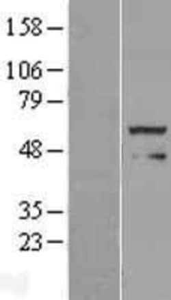 Novus Biologicals™ FOXRED1 Overexpression Lysate