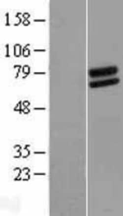 Novus Biologicals&trade;&nbsp;FOXRED2 Overexpression Lysate