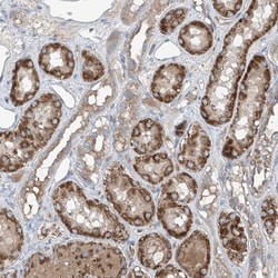 FOXRED2 Antibody, Novus Biologicals:Antibodies:Primary Antibodies