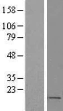 Novus Biologicals&trade;&nbsp;FOXS1 Overexpression Lysate