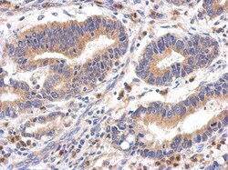FPGT Antibody, Novus Biologicals 0.1mL; Unlabeled:Antibodies, Polyclonal