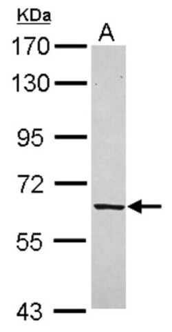 FPGT Antibody, Novus Biologicals 0.1mL; Unlabeled:Antibodies, Polyclonal
