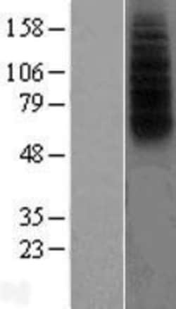 Novus Biologicals&trade;&nbsp;FPRL1/FPR2 Overexpression Lysate